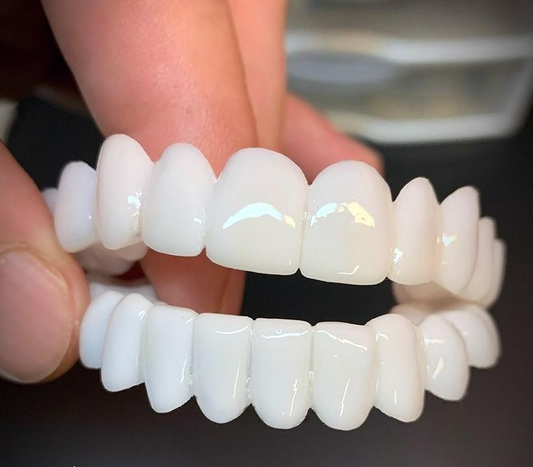 AuraSmile – Adjustable Clear Whitening Braces